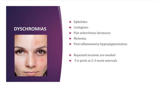 DYSCHROMIAS
 Ephelides
 Lentigines
 Flat seborrhoeic keratoses
 Melasma
 Post inflammatory hyperpigmentation
 Repeated sessions are needed
 5-6 peels at 2-3 week intervals
 