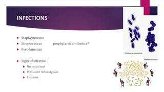 INFECTIONS
 Staphylococcus
 Streptococcus prophylactic antibiotics?
 Pseudomonas
 Signs of infection
 Necrotic crust
 Persistent redness/pain
 Erosions
 