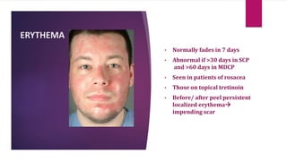ERYTHEMA
• Normally fades in 7 days
• Abnormal if >30 days in SCP
and >60 days in MDCP
• Seen in patients of rosacea
• Those on topical tretinoin
• Before/ after peel persistent
localized erythema
impending scar
 