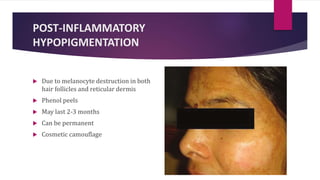 POST-INFLAMMATORY
HYPOPIGMENTATION
 Due to melanocyte destruction in both
hair follicles and reticular dermis
 Phenol peels
 May last 2-3 months
 Can be permanent
 Cosmetic camouflage
 