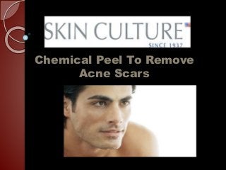 Chemical Peel To Remove
Acne Scars
 