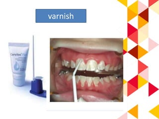 varnish
 