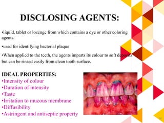 96
DISCLOSING AGENTS:
•liquid, tablet or lozenge from which contains a dye or other coloring
agents.
•used for identifying bacterial plaque
•When applied to the teeth, the agents imparts its colour to soft deposits
but can be rinsed easily from clean tooth surface.
IDEAL PROPERTIES:
•Intensity of colour
•Duration of intensity
•Taste
•Irritation to mucous membrane
•Diffusibility
•Astringent and antiseptic property
 