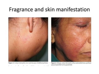 Pefume Rash Chemicals_cosmetics_and_other_occupational_skin_problems_pptx.pdf