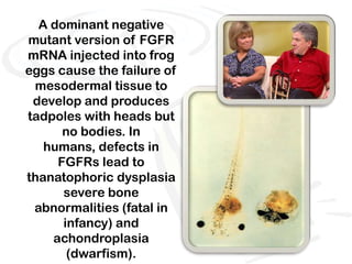 A dominant negative
mutant version of FGFR
mRNA injected into frog
eggs cause the failure of
 mesodermal tissue to
 develop and produces
tadpoles with heads but
      no bodies. In
   humans, defects in
     FGFRs lead to
thanatophoric dysplasia
      severe bone
 abnormalities (fatal in
      infancy) and
    achondroplasia
       (dwarfism).
 