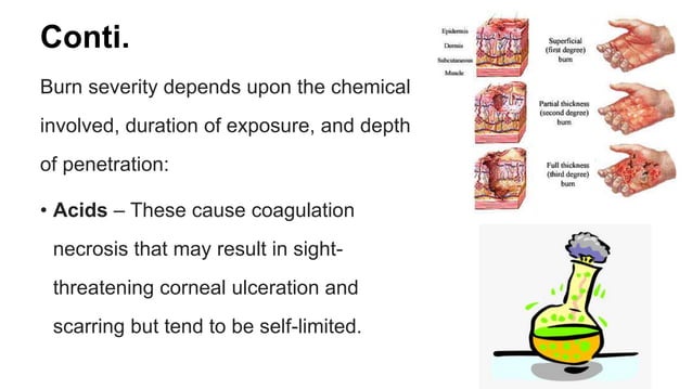 Chemical Spill And Chemical Burn Management.pptx