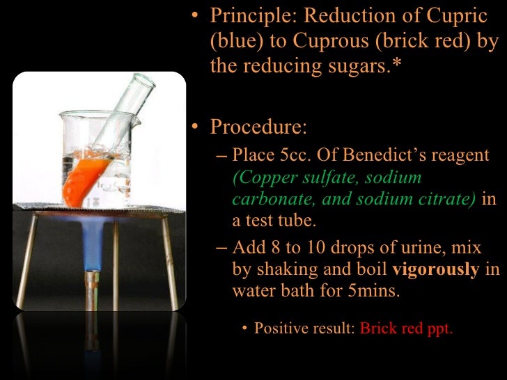 Chemical tests for urine