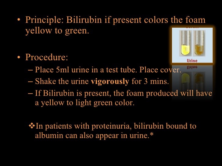 Chemical tests for urine