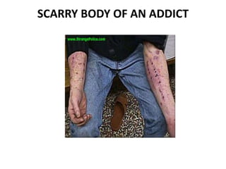 SCARRY BODY OF AN ADDICT 
 