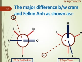 The major difference b/w cram
and Felkin Anh as shown as:-
Nu
Nu
T,S by Felkin Anh T,S by Charm
4/10/2018
64
 