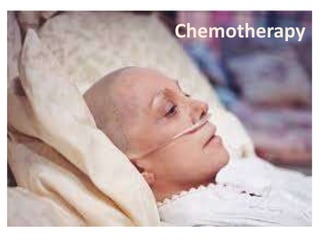 Chemotherapy

 