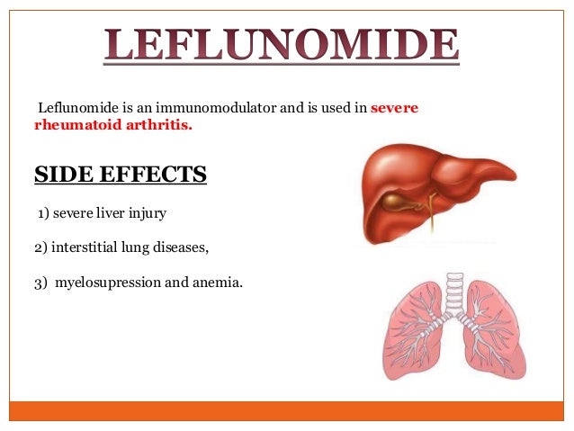 leflunomide effect on liver