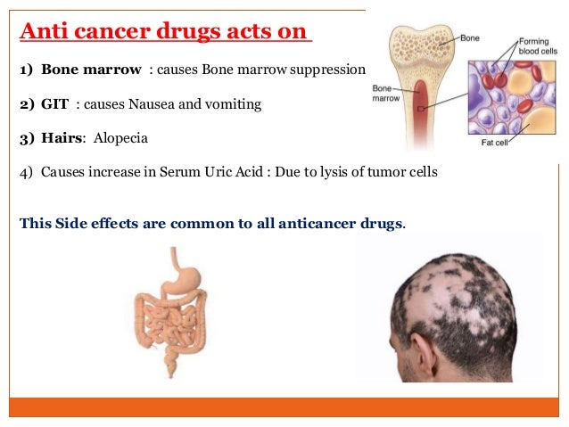 Chemotherapy Chemotherapy