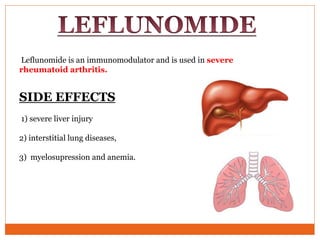 Leflunomide is an immunomodulator and is used in severe
rheumatoid arthritis.
SIDE EFFECTS
1) severe liver injury
2) interstitial lung diseases,
3) myelosupression and anemia.
 