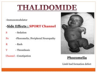 -Immunomodulator
-Side Effects : SPORT Channel
S - Sedation
Po -Phocomelia /Peripheral Neuropathy
R - Rash
T - Thrombosis
Channel - Constipation
Phocomelia
Limb bud formation defect
 