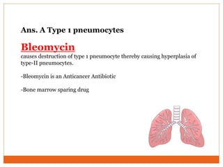 Ans. A Type 1 pneumocytes
Bleomycin
causes destruction of type 1 pneumocyte thereby causing hyperplasia of
type-II pneumocytes.
-Bleomycin is an Anticancer Antibiotic
-Bone marrow sparing drug
 