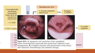 Head and neck contracts programme
 