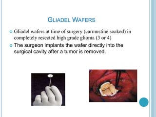 GLIADEL WAFERS
 Gliadel wafers at time of surgery (carmustine soaked) in
completely resected high grade glioma (3 or 4)
 The surgeon implants the wafer directly into the
surgical cavity after a tumor is removed.
 