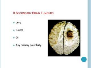 II SECONDARY BRAIN TUMOURS
 Lung
 Breast
 GI
 Any primary potentially
 