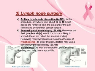 Chemotherapy of breast cancer | PPTX