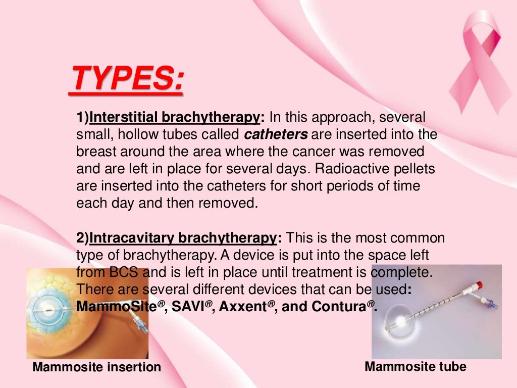 Chemotherapy of breast cancer