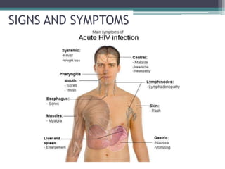 SIGNS AND SYMPTOMS
 