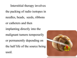 Interstitial Radiotherapy Chemotherapy & Radiation Therapy | PPTX