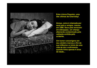 Esta é Anna Pesenko, uma
                                das vítimas de Chernobyl.


                                Annya, como é chamada por
                                seus pais e amigos, nasceu
                                em 1990. Seus pais moravam
                                em Zakopytye, um vilarejo
                                altamente contaminado pela
                                radiação emitida pelo
                                acidente.
Foto: Greenpeace/Robert Knoth




                                Um tumor cancerígeno em
                                seu cérebro marcou o fim de
                                sua infância e o início de uma
                                vida de dor e sofrimento,
                                quando tinha apenas 4 anos
                                de idade...
 
