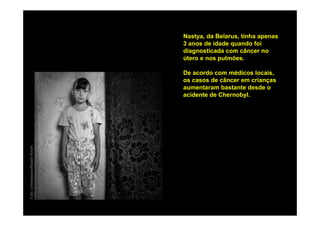 Nastya, da Belarus, tinha apenas
                                3 anos de idade quando foi
                                diagnosticada com câncer no
                                útero e nos pulmões.

                                De acordo com médicos locais,
                                os casos de câncer em crianças
                                aumentaram bastante desde o
                                acidente de Chernobyl.
Foto: Greenpeace/Robert Knoth
 