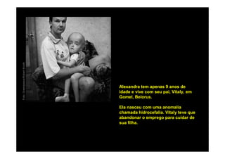 Foto: Greenpeace/Robert Knoth




                                Alexandra tem apenas 9 anos de
                                idade e vive com seu pai, Vitaly, em
                                Gomel, Belorus.

                                Ela nasceu com uma anomalia
                                chamada hidrocefalia. Vitaly teve que
                                abandonar o emprego para cuidar de
                                sua filha.
 