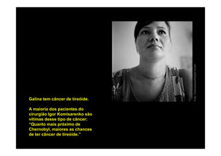 Foto: Greenpeace/Robert Knoth
Galina tem câncer de tireóide.

A maioria dos pacientes do
cirurgião Igor Komisarenko são
vítimas desse tipo de câncer:
“Quanto mais próximo de
Chernobyl, maiores as chances
de ter câncer de tireóide.”
 