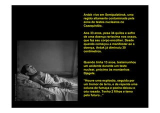 Ardak vive em Semipalatinsk, uma
                                região altamente contaminada pela
                                zona de testes nucleares no
                                Cazaquistão.

                                Aos 33 anos, pesa 34 quilos e sofre
                                de uma doença raríssima nos ossos,
                                que faz seu corpo encolher. Desde
                                quando começou a manifestar-se a
                                doença, Ardak já diminuiu 30
                                centímetros.


                                Quando tinha 13 anos, testemunhou
                                um acidente durante um teste
                                nuclear, próximo às montanhas
                                Djegele.
Foto: Greenpeace/Robert Knoth




                                “Houve uma explosão, seguida por
                                um tremor de terra, e de repente uma
                                coluna de fumaça e poeira deixou o
                                céu rosado. Tenho 2 filhos e temo
                                pelo futuro...”
 