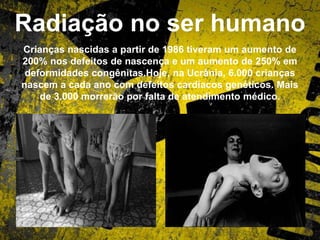 Radiação no ser humano
Crianças nascidas a partir de 1986 tiveram um aumento de
200% nos defeitos de nascença e um aumento de 250% em
deformidades congênitas.Hoje, na Ucrânia, 6.000 crianças
nascem a cada ano com defeitos cardíacos genéticos. Mais
de 3.000 morrerão por falta de atendimento médico.
 