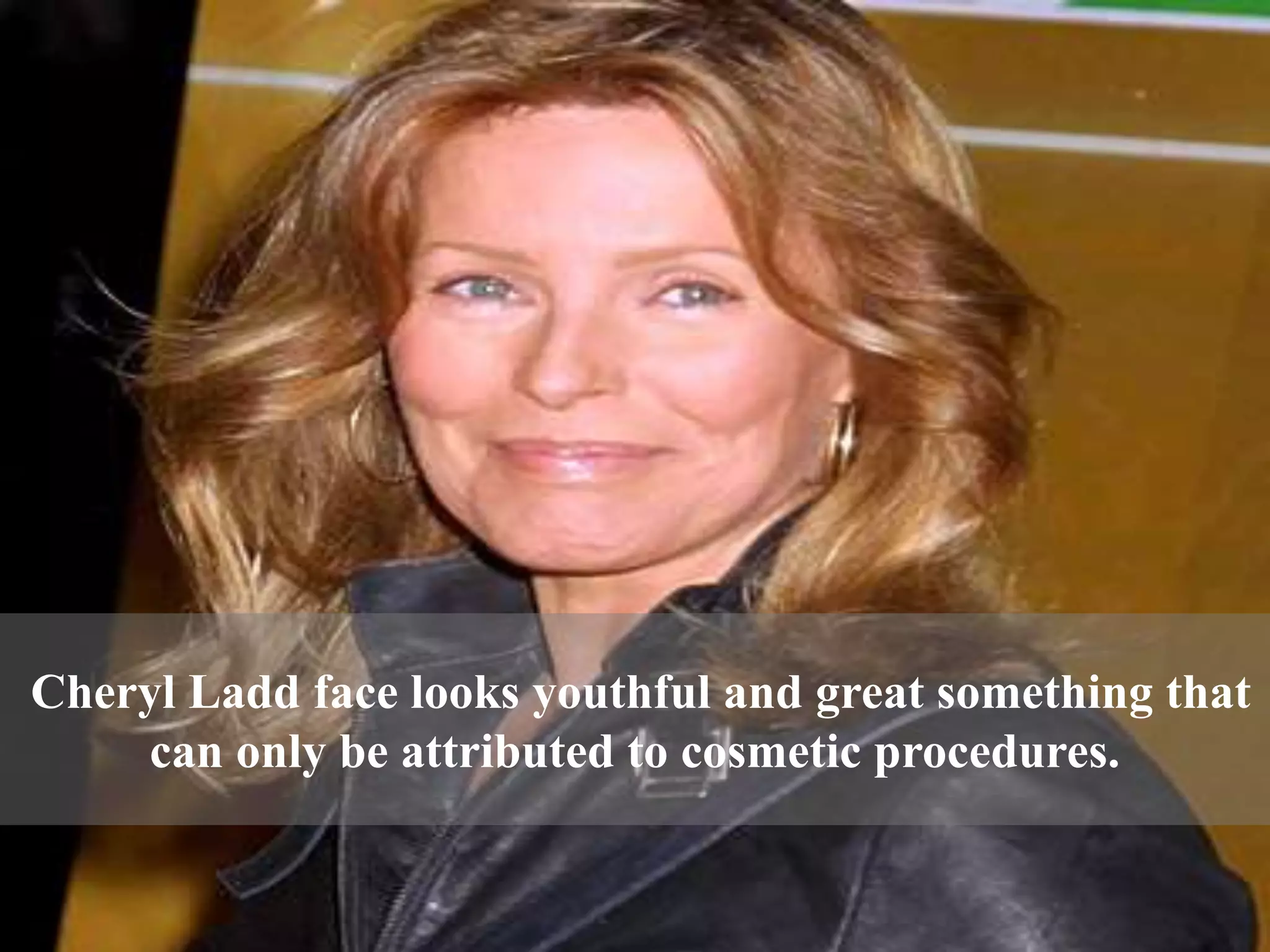 Cheryl ladd plastic surgery | PPTX