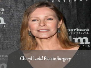 Cheryl Ladd Plastic Surgery
 