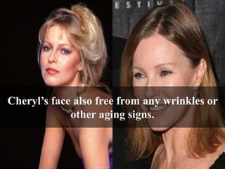 cheryl ladd plastic surgery Image 6