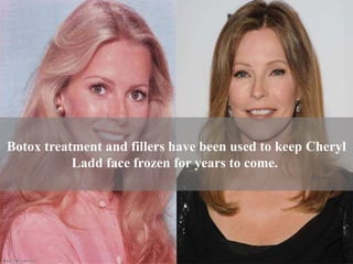 cheryl ladd plastic surgery Image 3