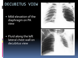 chest examination.pptx.pdf