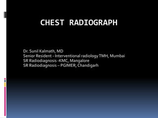 CHEST RADIOGRAPH
Dr. Sunil Kalmath, MD
Senior Resident - Interventional radiologyTMH, Mumbai
SR Radiodiagnosis -KMC, Mangalore
SR Radiodiagnosis – PGIMER, Chandigarh
 