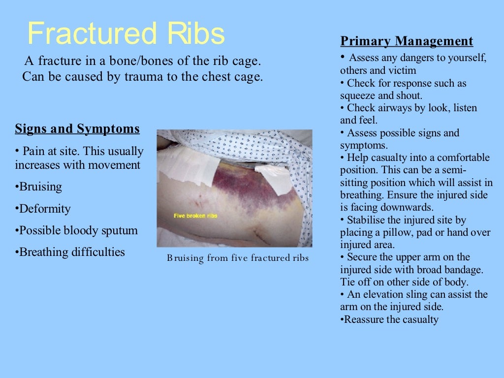 Chest Injuries