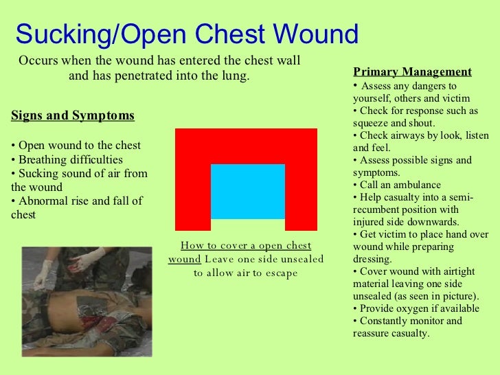 Chest Injuries
