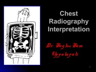 11
ChestChest
RadiographyRadiography
InterpretationInterpretation
Dr. Raghu RamDr. Raghu Ram
UppalapatiUppalapati
 