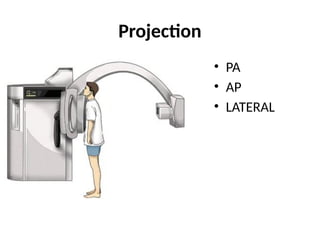 Chest-X-ray-Quality.presentations for med | PPTX