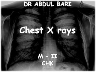 1
Dr Abdul Bari
 