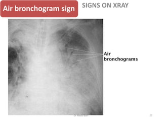 chest-x-ray-teaching-tutorial.pptx