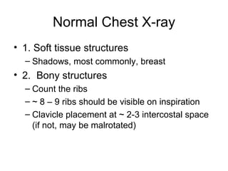 X Ray Rib Count Chest X Ray Interpretation | PPT