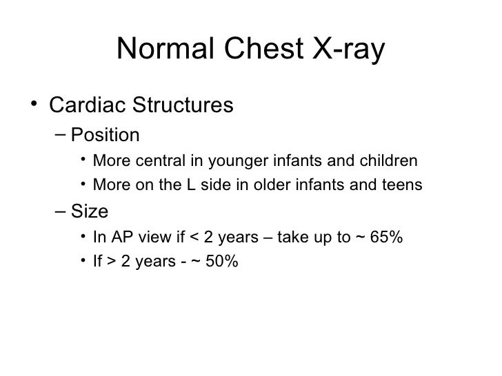 Write My Essay Online for Cheap how to write normal chest x ray