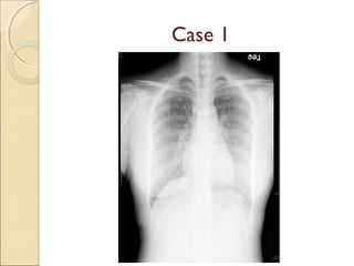 Case 1
 