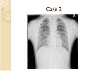 Case 2
 