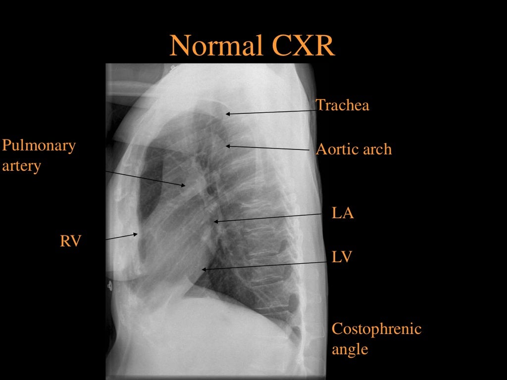 Radiology Chest Imaging